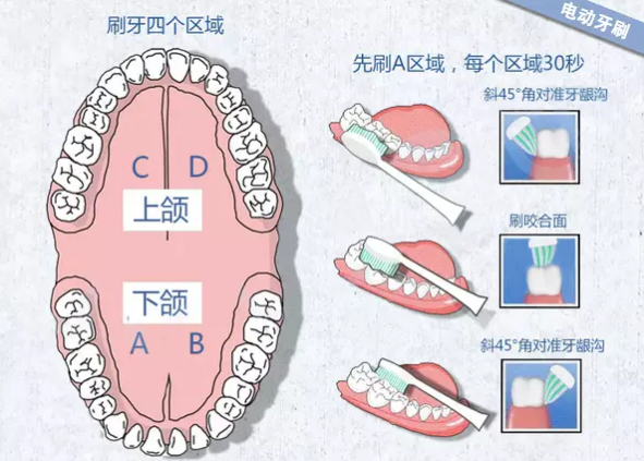 锐迈